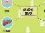 病理性黄疸症状及表现 病理性黄疸症状