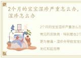 2个月的宝宝湿疹严重怎么办，两个月宝宝湿疹怎么办