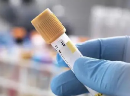 HIV疫苗临床试验提供了有希望的结果