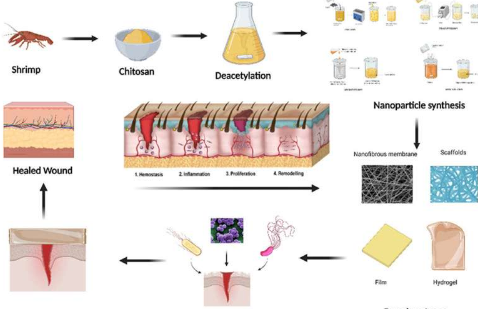 用于伤口敷料的可持续壳聚糖纳米复合材料的进展
