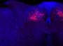 在小鼠中发现了控制身体炎症反应的新大脑回路