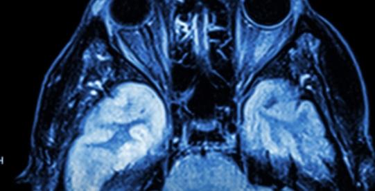 三一学院科学家获欧洲研究经费资助研究脑修复